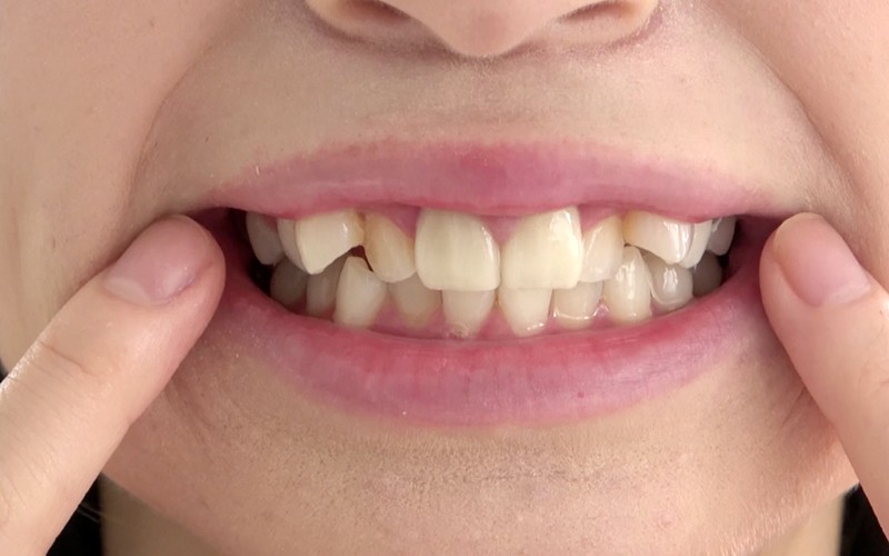 AD-416 Bagian 13 - 30 minit