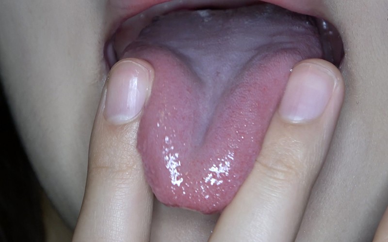 AD-424 第 3 部分 - 32 分钟