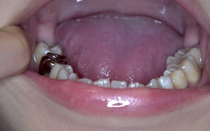 AD-424 第 7 部分 - 36 分钟