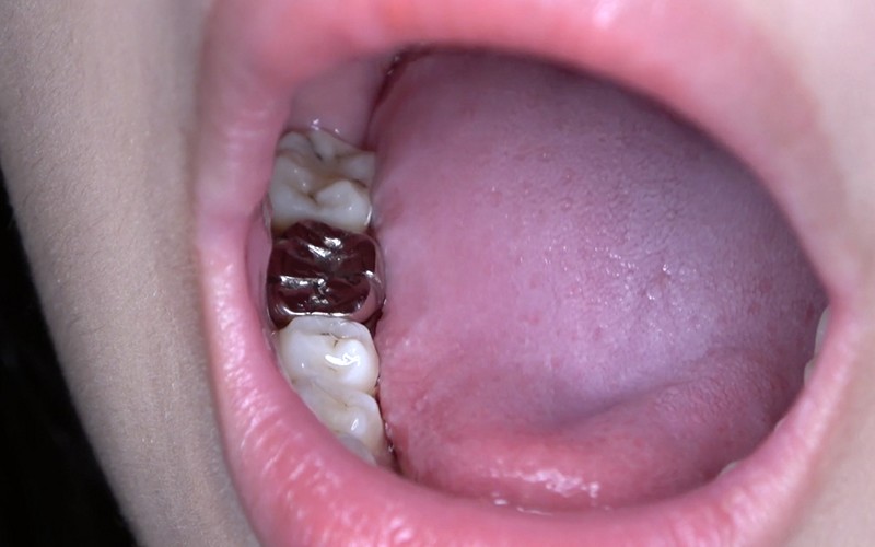 AD-424 第 9 部分 - 38 分钟