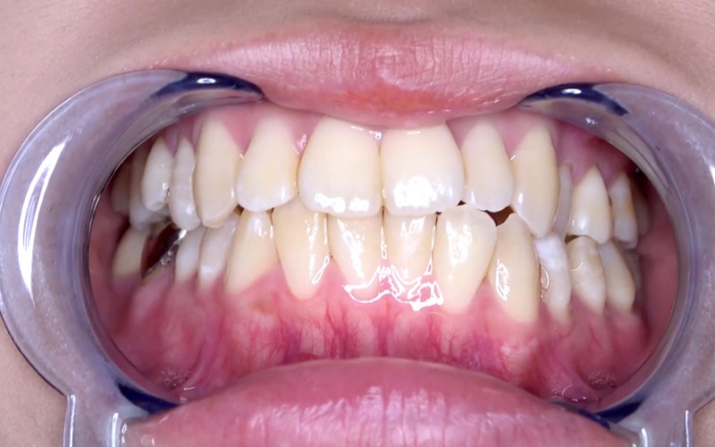 AD-427 Bagian 10 - 30 minit