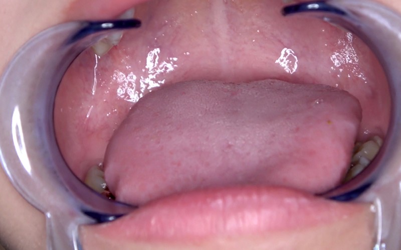 AD-427 Bagian 11 - 30 minit