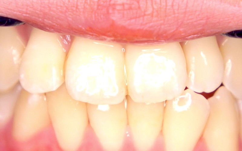 AD-427 Bagian 13 - 30 minit