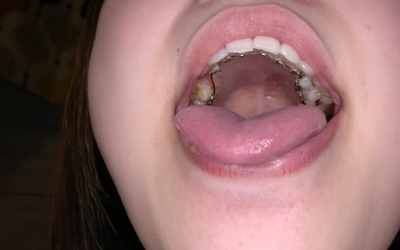 AD-434 Bagian 15 - 30 minit