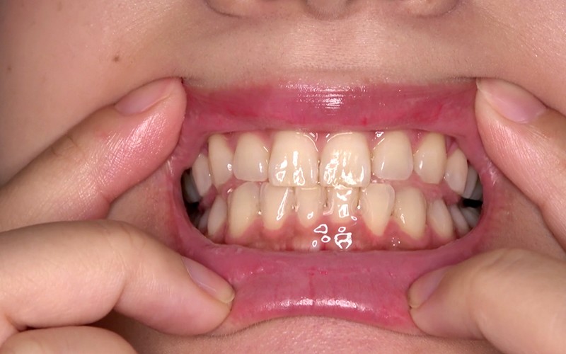 AD-438 第 11 部分 - 30 分钟