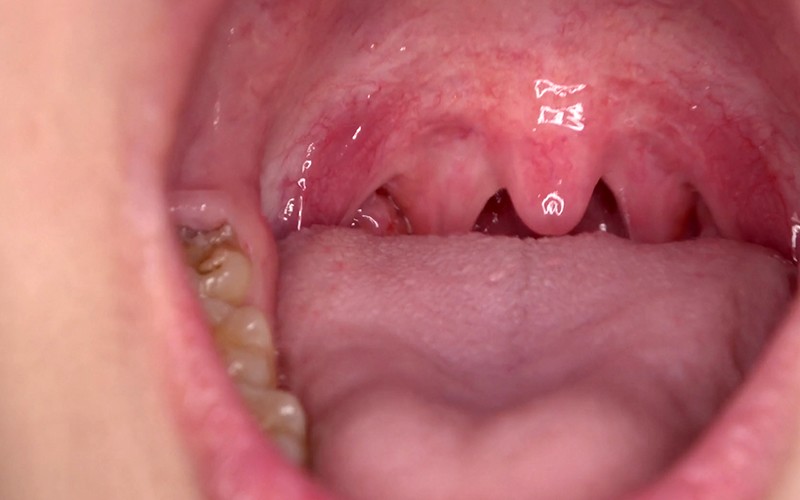 AD-438 第 15 部分 - 30 分钟