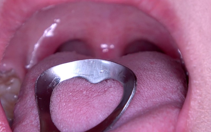 AD-446 第 13 部分 - 30 分钟