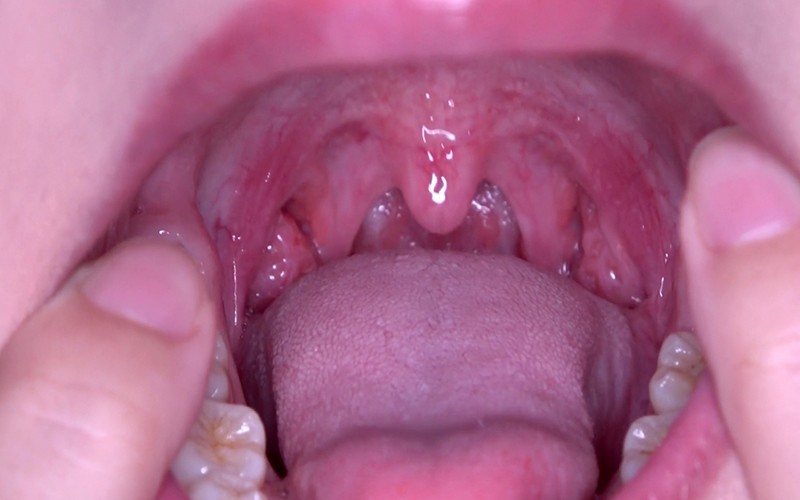 AD-446 第 14 部分 - 30 分钟