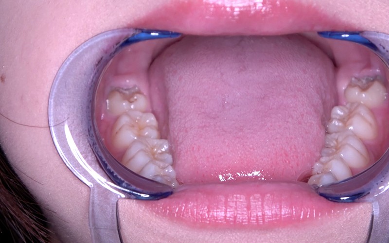 AD-446 第 5 部分 - 30 分钟