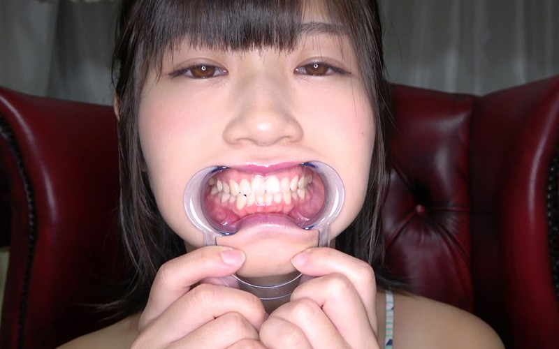 AD-453 第 2 部分 - 30 分钟