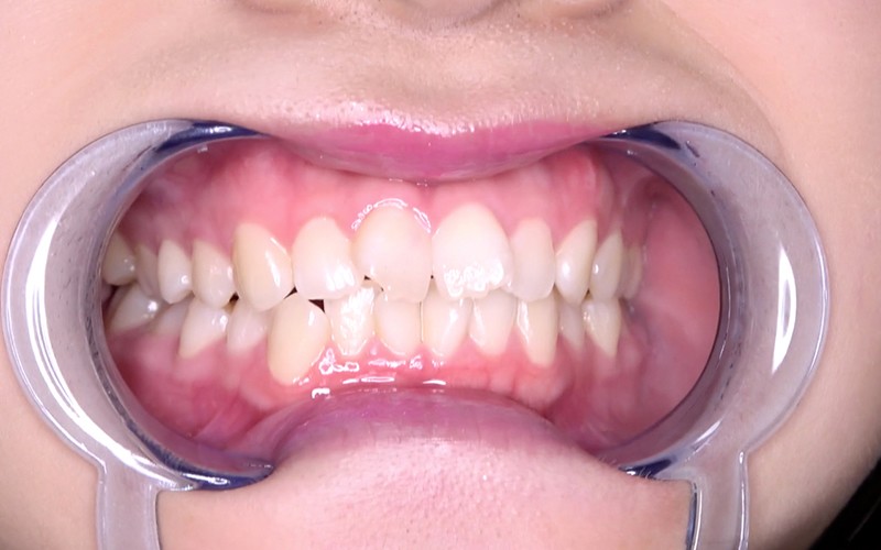 AD-453 第 4 部分 - 30 分钟