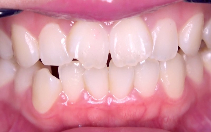 AD-453 第 5 部分 - 30 分钟