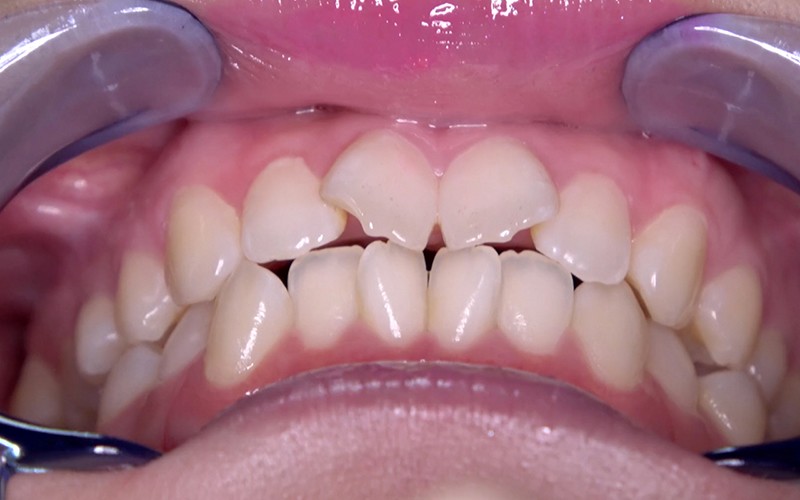 AD-453 第 6 部分 - 30 分钟