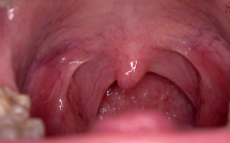 AD-467 Part 7 - 36 minutes