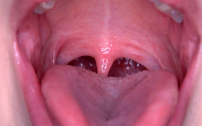 AD-481 第 6 部分 - 30 分钟