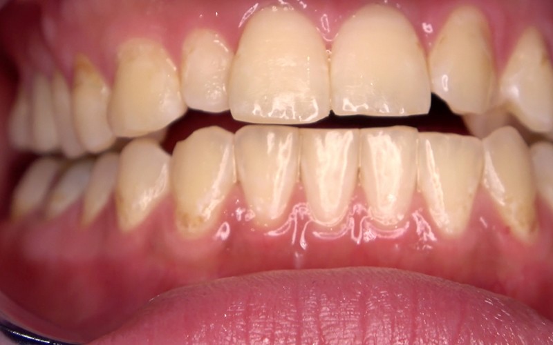 AD-487 Bagian 5 - 34 minit