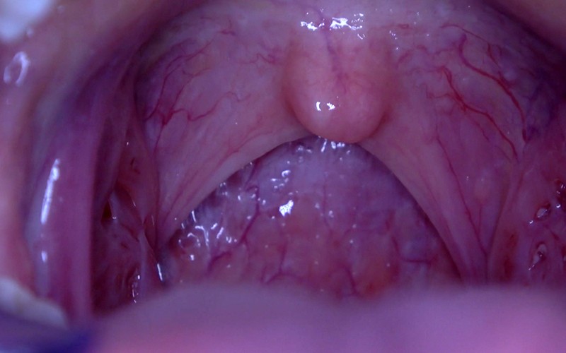 AD-503 第 10 部分 - 30 分钟