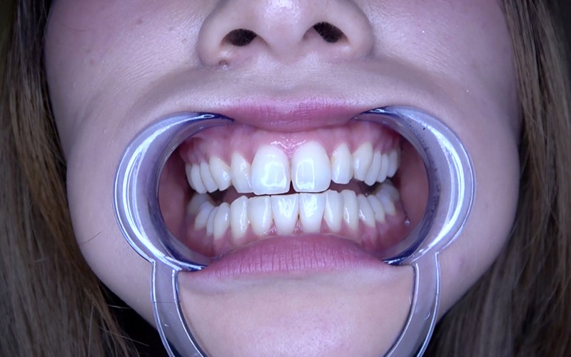 AD-503 パート 7 - 30 分