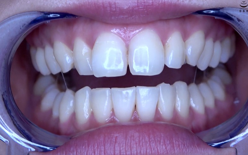 AD-503 第 8 部分 - 30 分钟