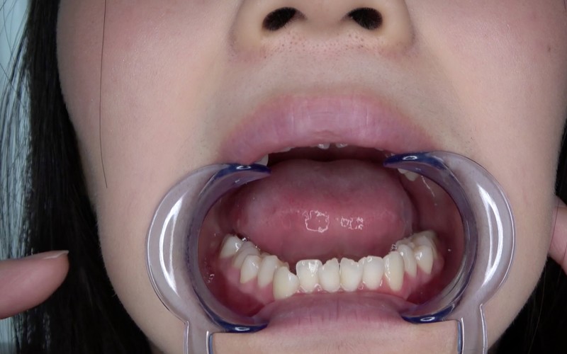 AD-504 パート 2 - 30 分