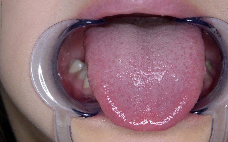 AD-504 第 5 部分 - 30 分钟