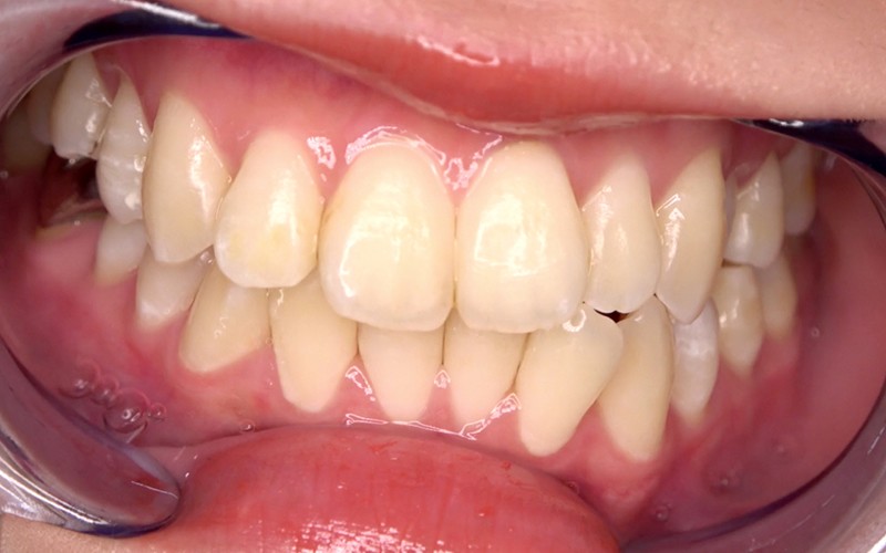 AD-510 パート 4 - 33 分