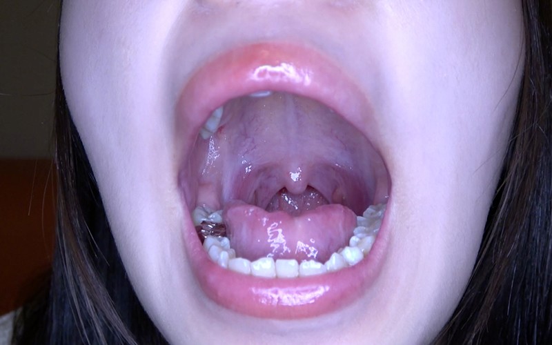 AD-513 Part 3 - 30 minutes