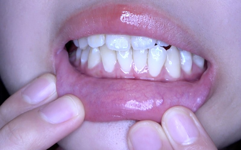 AD-513 パート 4 - 30 分