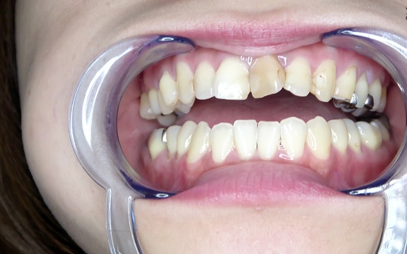 AD-523 パート 3 - 30 分