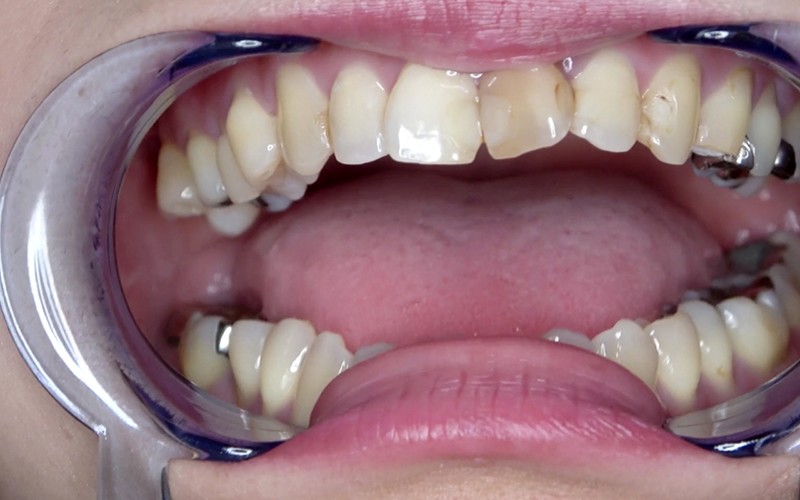 AD-523 Part 4 - 30 minutes