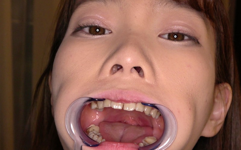 AD-534 第 10 部分 - 30 分钟