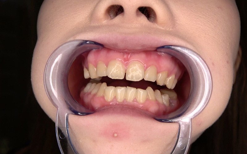 AD-534 第 3 部分 - 30 分钟