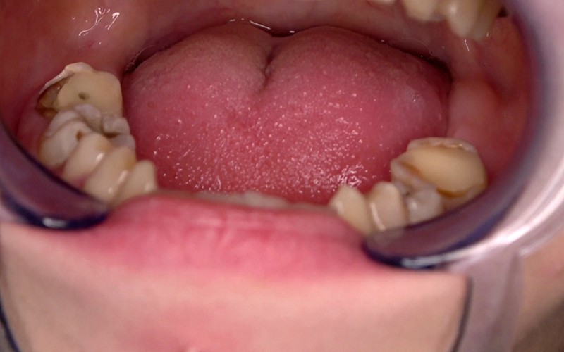 AD-534 Bagian 5 - 30 minit