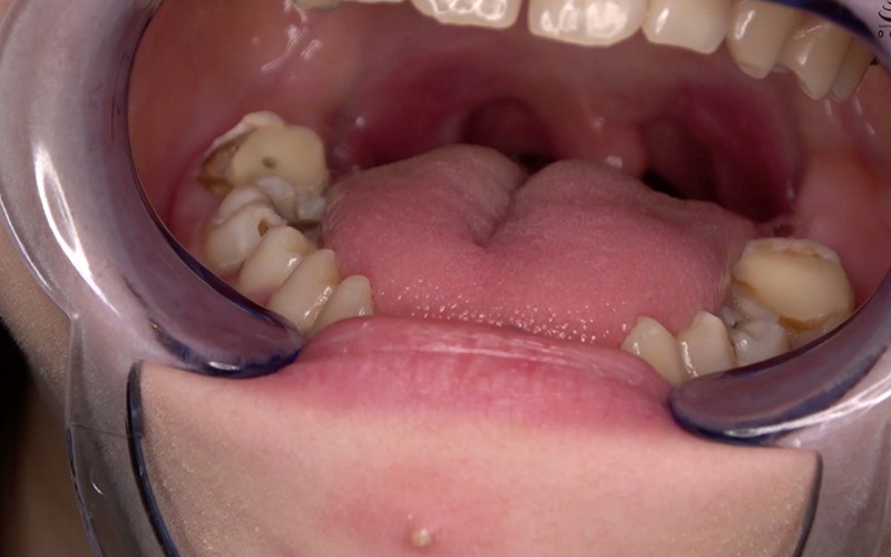 AD-534 第 6 部分 - 30 分钟