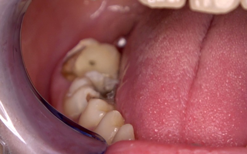 AD-534 Bagian 7 - 30 minit