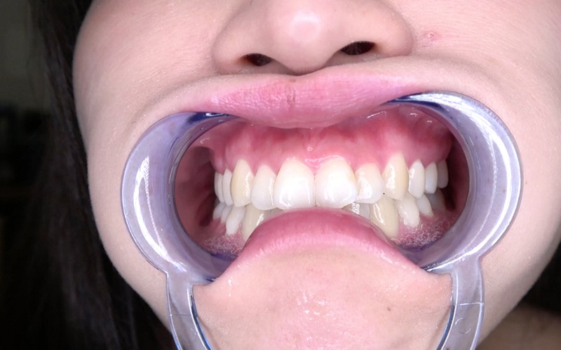 AD-558 Part 11 - 30 minutes