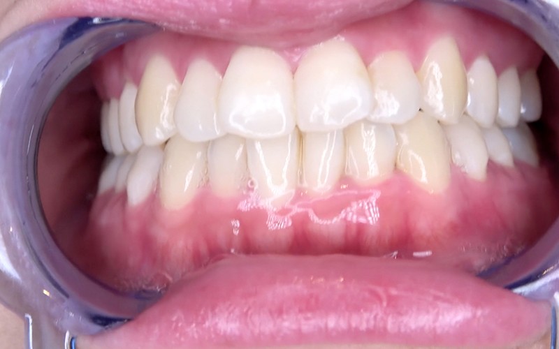 AD-558 Part 5 - 30 minutes