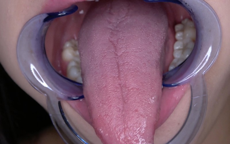 AD-558 Part 6 - 30 minutes