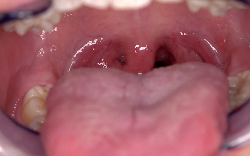 AD-565 Bagian 10 - 30 minit