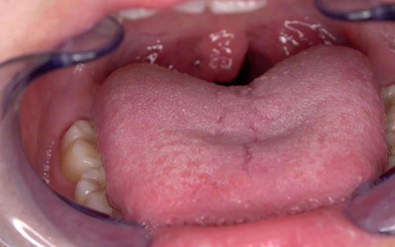 AD-565 Part 11 - 30 minutes