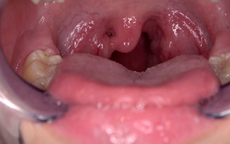 AD-565 Bagian 12 - 30 minit