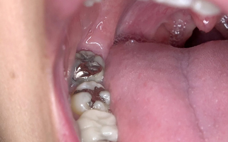 AD-579 Bagian 10 - 30 minit