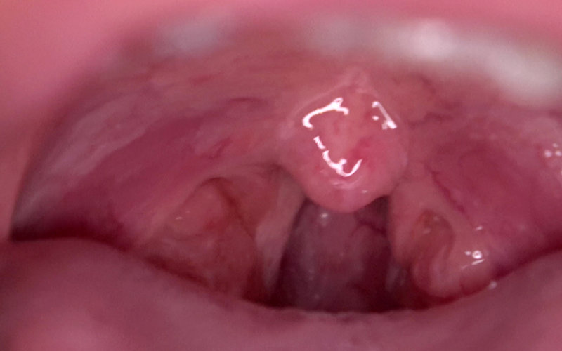 AD-579 Bagian 11 - 30 minit