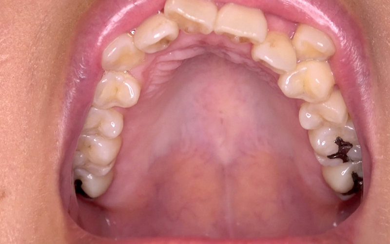 AD-579 Bagian 12 - 30 minit