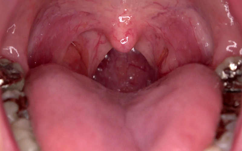 AD-579 Bagian 15 - 30 minit