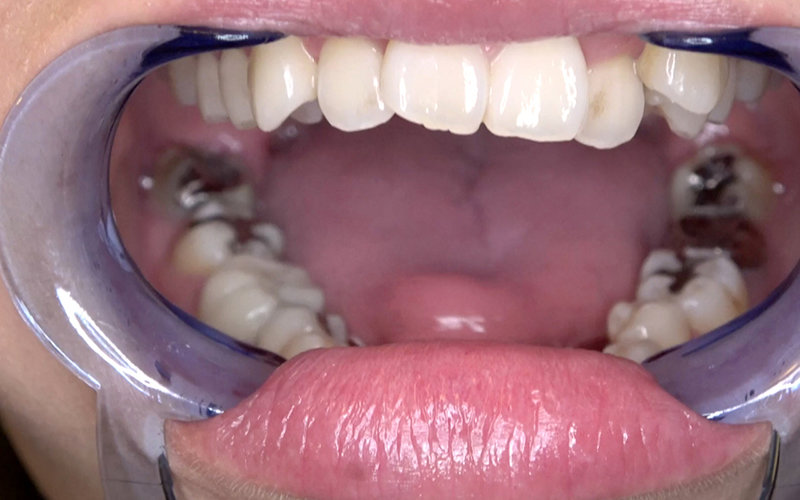 AD-579 Bagian 8 - 30 minit