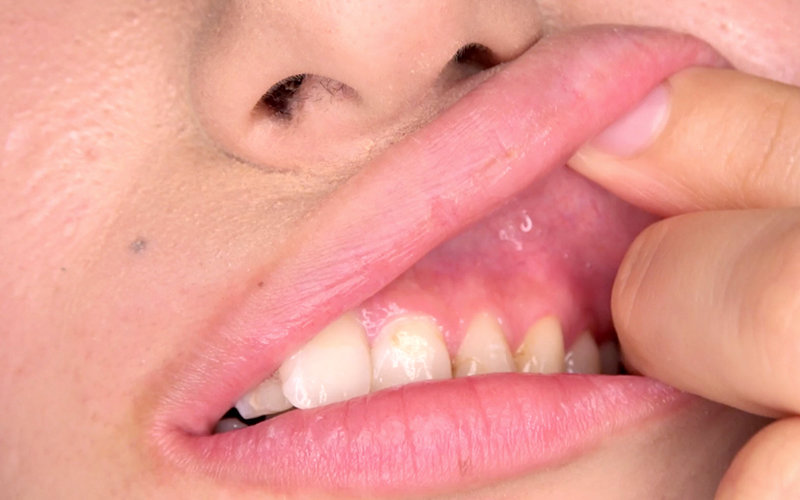 AD-585 Part 10 - 39 minutes