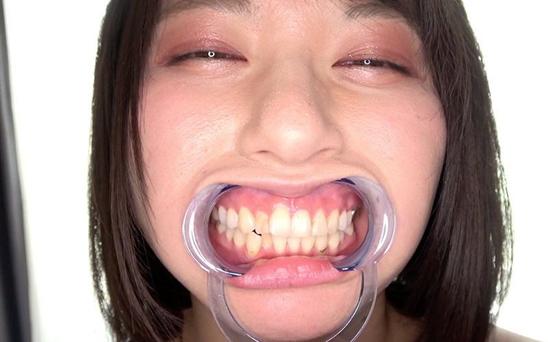 AD-585 パート 3 - 32 分