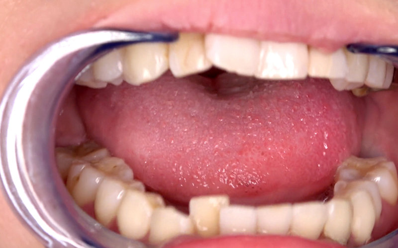 AD-585 パート 4 - 33 分