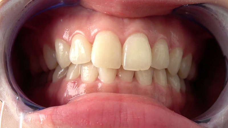 AD-599 Bagian 5 - 34 minit